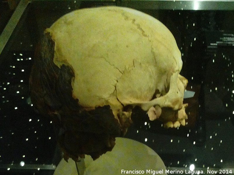 Museo Arqueol�gico de Tenerife - Museo Arqueol�gico de Tenerife. Cr�neo con parte momificado