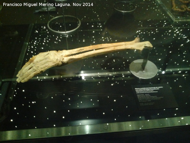 Museo Arqueol�gico de Tenerife - Museo Arqueol�gico de Tenerife. Brazo momificado